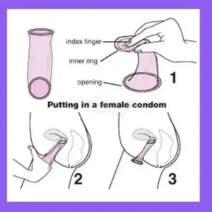 کاندوم زنانه